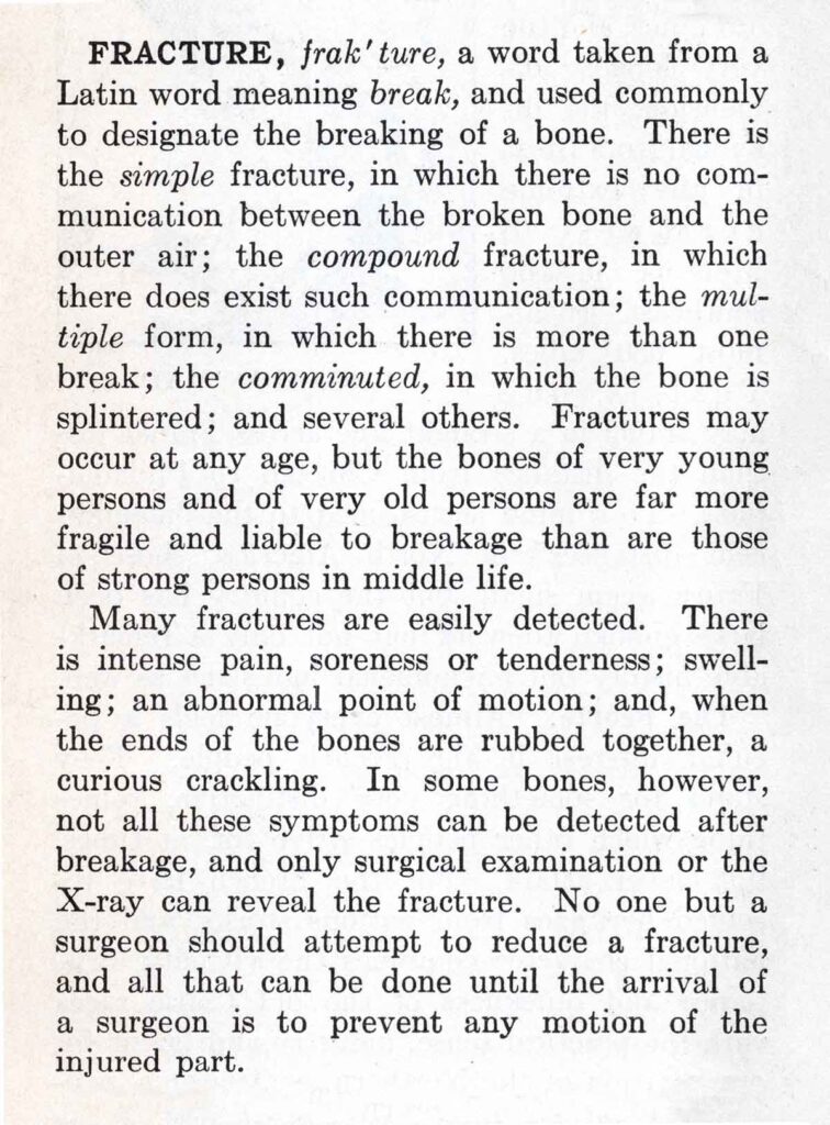 Fracture Webres